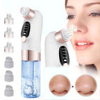 Pore Vacuum Cleaner Blackhead Remover with multiple suction heads for deep facial cleansing