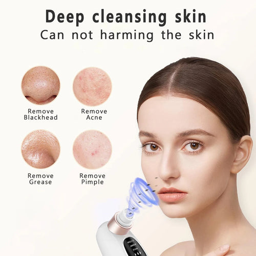 Electric blackhead remover vacuum tool used for deep pore cleaning and skincare