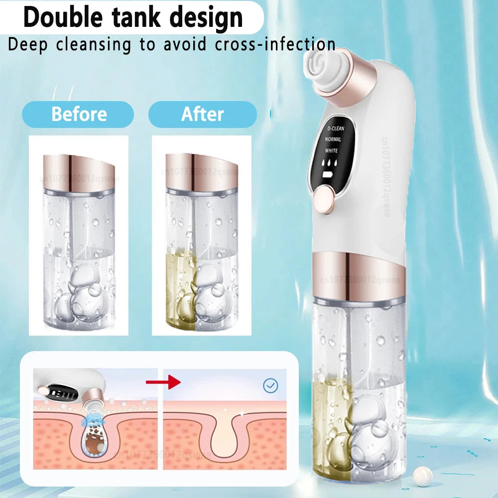 Facial pore cleanser with multiple interchangeable suction tips and adjustable settings