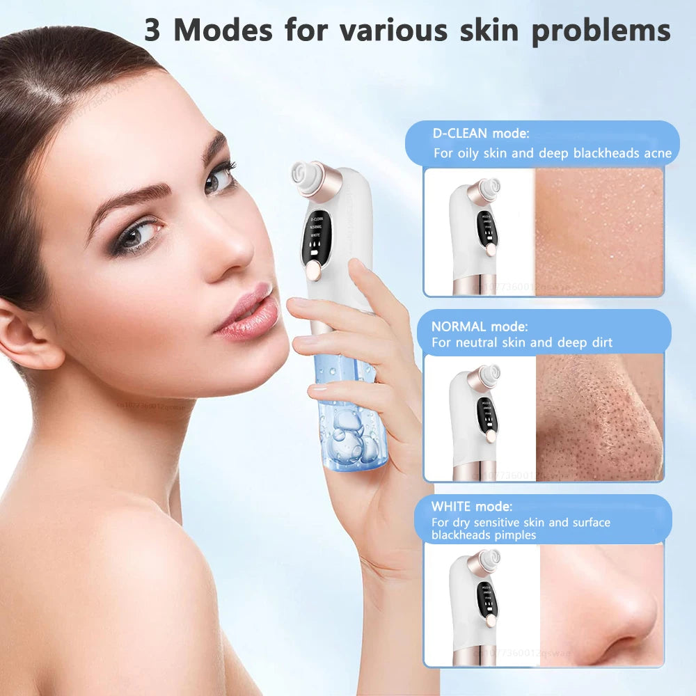 Electric pore vacuum cleaner designed for removing excess oil and skin impurities