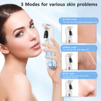 Electric pore vacuum cleaner designed for removing excess oil and skin impurities